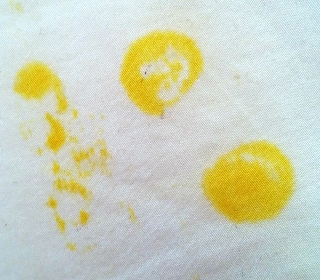 A photo of two circular bright yellow fluorescent stains on Emma Woods's bedding.